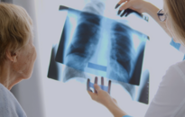 Február 28. – A Ritka Betegségek Világnapja: Mit kell tudni a tüdőfibrózisról?