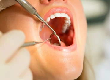 Egyre többen szenvednek fogínybetegségben