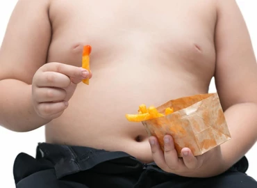 Az elhízott gyermekeknél nagyobb a szklerózis multiplex kockázata