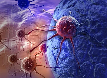 Láthatóvá tették a rejtőzködő rákos sejteket az immunrendszer számára a Yale kutatói