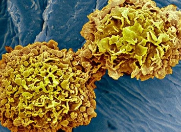 A rák leggyakoribb fajtáit szűrő vérvizsgálatot teszteltek