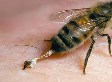Nem alkalmas a kalcium a méh- vagy darázscsípések kezelésére